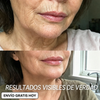 STICK REPULPANTE BIO-COLÁGENO PDRN