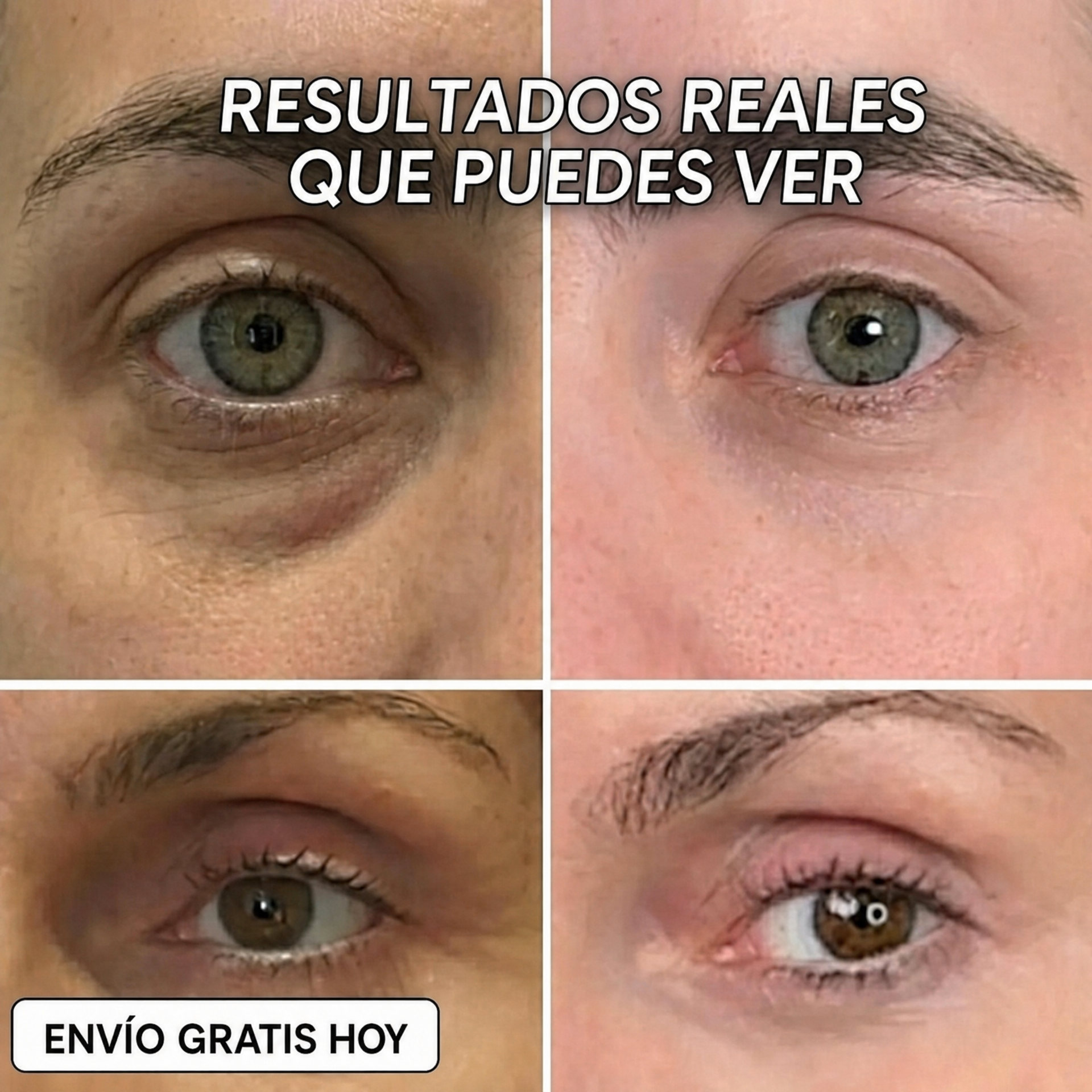 STICK REPULPANTE BIO-COLÁGENO PDRN